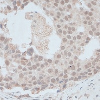 Anti-ZNF703 Antibody