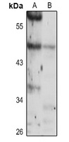 ZNF763 Antibody