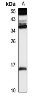 ZNRD1 Rabbit Polyclonal Antibody