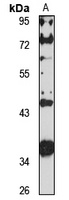 ZSCAN1 Antibody