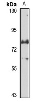 ZFP29 Rabbit Polyclonal Antibody