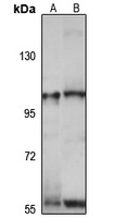ZSCAN20 Rabbit Polyclonal Antibody