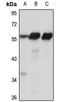 ZSCAN21 Antibody