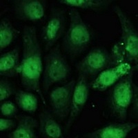 Anti-ZWINT Antibody