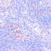 Anti-Zyxin Antibody