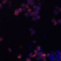 Anti-Zyxin Antibody