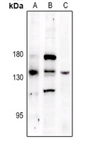 PERK (Phospho-T982) Antibody