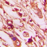 PERK (Phospho-T982) Antibody
