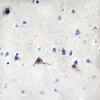 beta Amyloid antibody