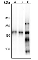 NMDAR2B Rabbit Polyclonal Antibody