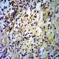 Anti-Adiponectin Antibody