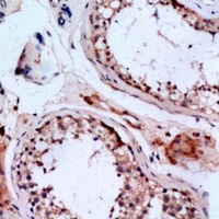 CMTM6 Antibody