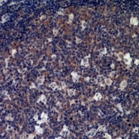 Anti-IL-33 Antibody