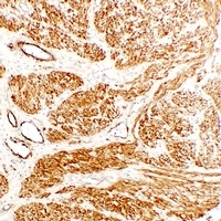 Anti-Caldesmon Antibody