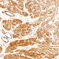 Caldesmon antibody