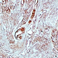 Caldesmon antibody