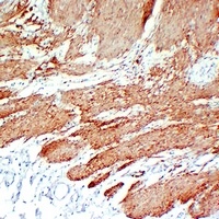 Calponin 1 Antibody