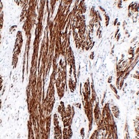 Anti-Calponin 1 Antibody
