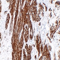 Calponin 1 antibody