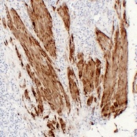 Anti-Calponin 1 Antibody