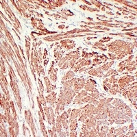 Anti-Calponin 1 Antibody