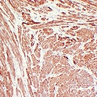 Calponin 1 antibody