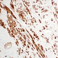 Anti-Calponin 1 Antibody