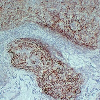 CD21 Antibody
