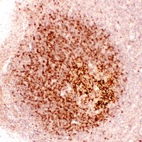 CD23 antibody
