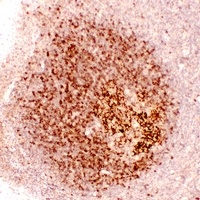 Anti-CD23 Antibody