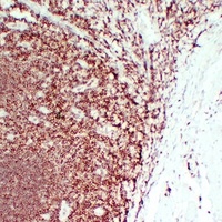 CD45 Mouse Monoclonal Antibody