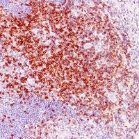 CD5 Mouse Monoclonal Antibody