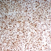 CD68 antibody