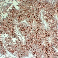 CD99 Antibody
