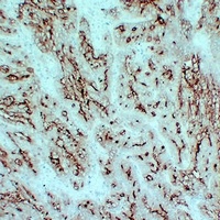 CD66e Antibody