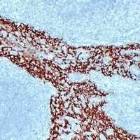 Cytokeratin 14 Mouse Monoclonal Antibody