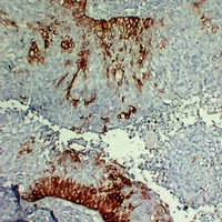 Cytokeratin 15 Antibody