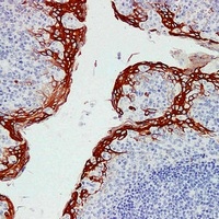 Cytokeratin 16 antibody