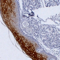 Cytokeratin 4 Antibody
