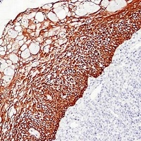 Cytokeratin 5/6 antibody