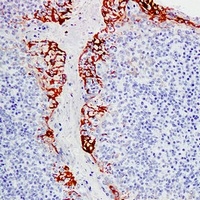 Anti-MUC1 Antibody