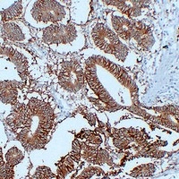 CD326 Mouse Monoclonal Antibody