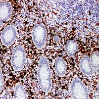 Anti-Factor XIIIa Antibody