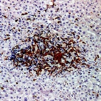 Factor XIIIa antibody