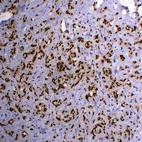 Anti-FLI1 Antibody