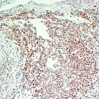 Anti-FLI1 Antibody