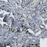 Gastrin Mouse Monoclonal Antibody