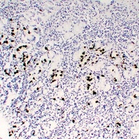 Gastrin Mouse Monoclonal Antibody