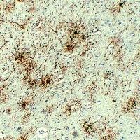 Anti-GFAP Antibody