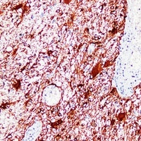 Anti-GFAP Antibody